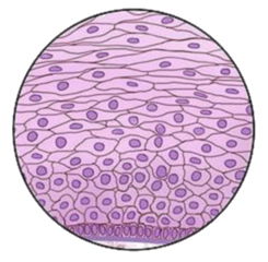 Image - Indications NETs