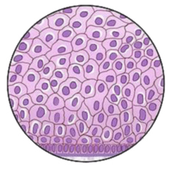 Image - Indications NETs